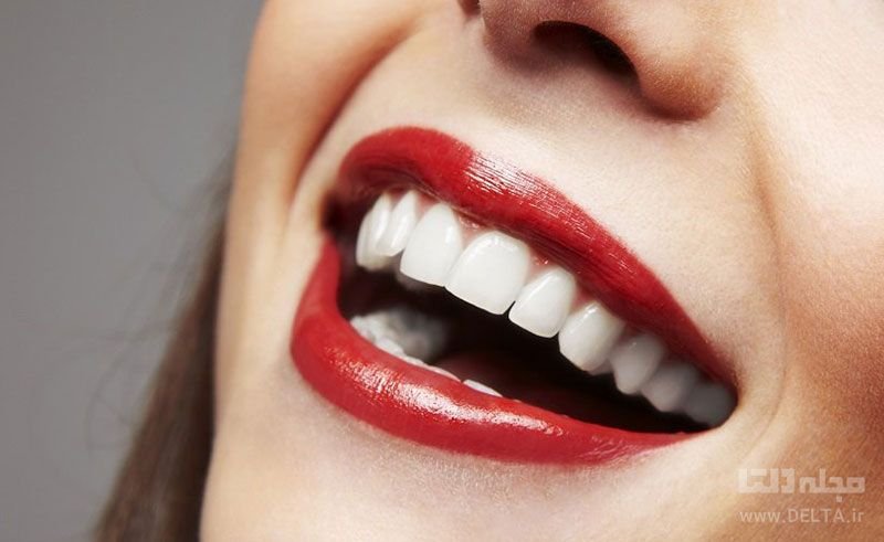 راهکار های ساده برای سفید کردن دندان‌