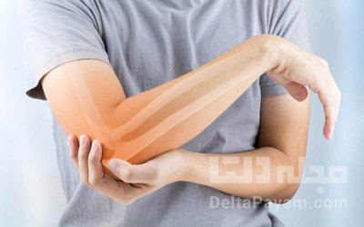 تشدید علائم آرتروز