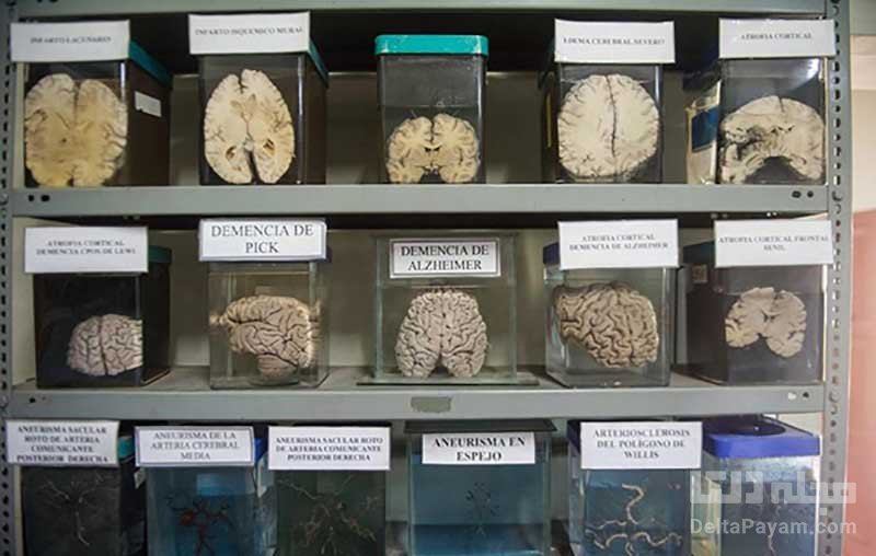 موزه مغز