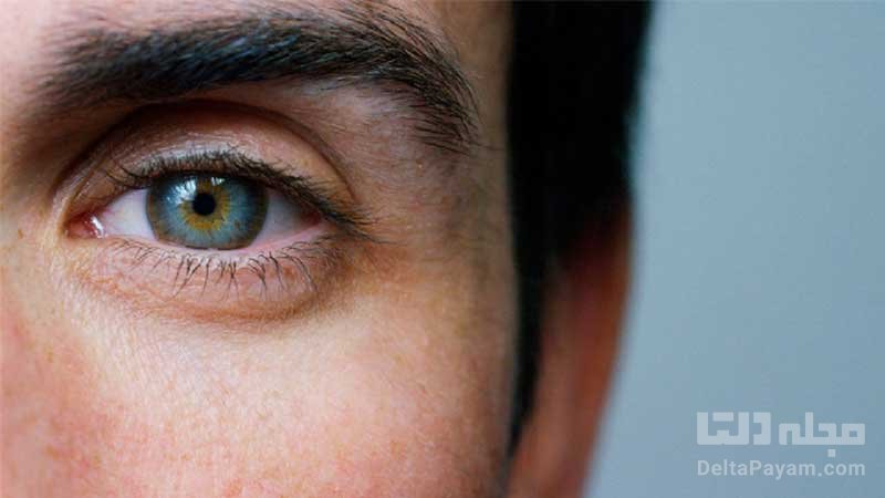 روش تشخیص بیماری از روی چشم