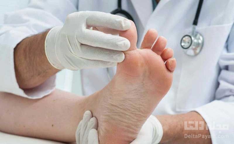 بیماری های مرتبط با پا