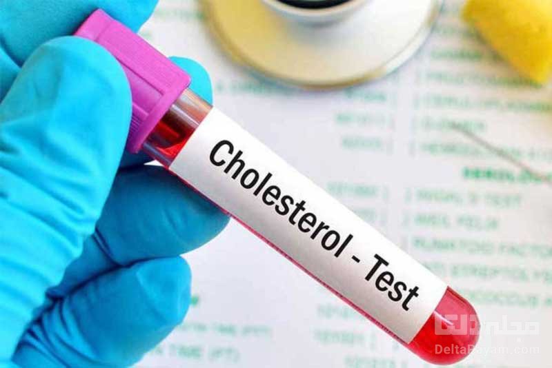 علائم کلسترول خون چیست؟