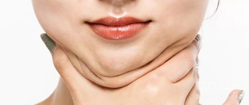 ترفندهایی برای از بین بردن غبغب