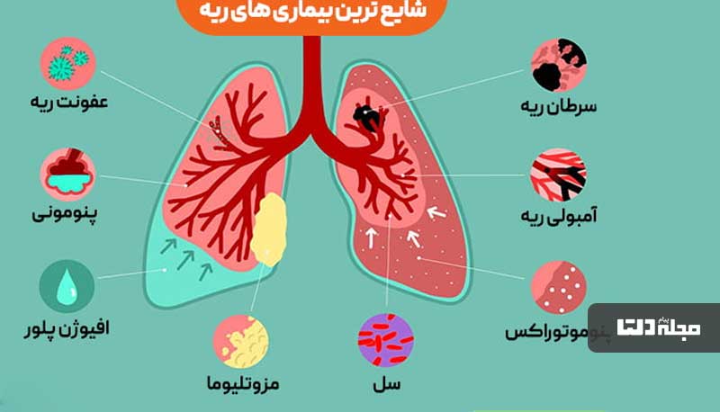 غذا‌های پاک کننده ریه بخورید